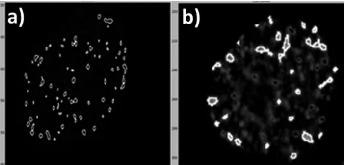 Figure 8 - Illustration of differences in counting of  γ H2AX foci per HTB140 cell nucleus irradiated with 8 Gy  γ -rays, obtained  by the microscopes AxioVision comprising ApoTome software (a) and AxioImagerA1 (b)