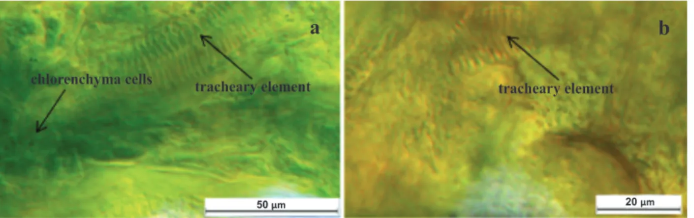 Figure 1 -  Plant tissue inside the gut of A. argillacea.  a : chlorenchyma cells and tracheary elements in the gut of a neonate larva  of A