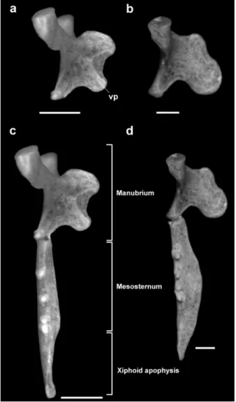 Figure 10 - Lateral view of manubrium of sternum: a. 