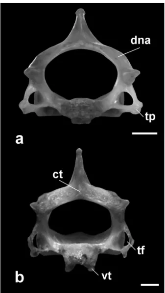 Figure 5 - Posterior view of axis: a. Desmodus rotundus: neural  arch simple; b. Chrotopterus auritus: neural arch with a central  tubercle and two concavities