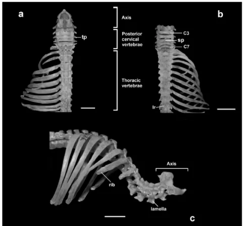 Figure 6 - Dorsal view of cervical and thoracic regions: a. Chrotopterus auritus; b. 