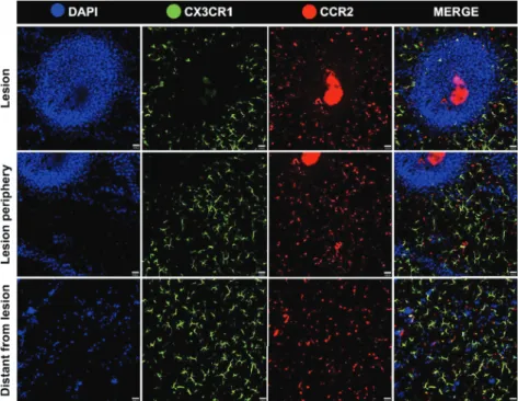 Figure 7 -  Dynamics of phagocytic populations under liver injury. Assessing migration  dynamics of CX3CR1+ (green) and CCR2+ (red) to three diff erent areas simultaneously  using the multi-point imaging feature of Nikon A1R (necrotic zones, areas around  