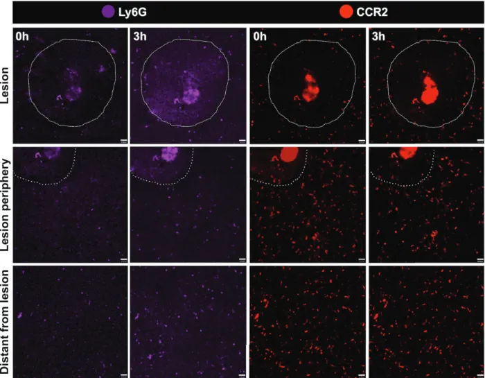 Figure 8 -  Dynamics of phagocytic populations under liver injury. Assessing migration dynamics of Ly6G +  (purple)﻿ and CCR2 + (red)﻿ to necrotic zones, areas around necrosis and areas distant from necrosis using intravital microscopy