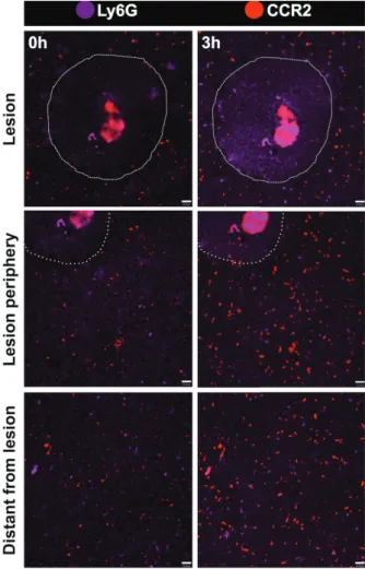 Figure 9 -  Dynamics of phagocyte populations under liver  injury. Assessing migration dynamics of Ly6G +  (purple)﻿ 