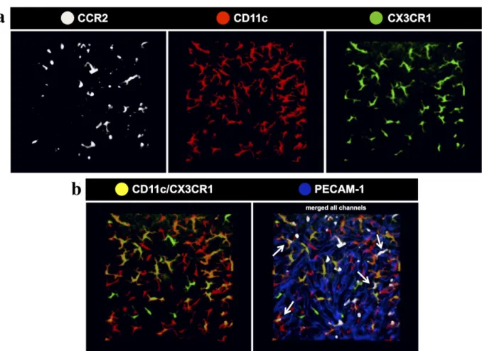 Figure 6 - Efficient spectral separation of liver phagocytes from triple fluorescent mouse CX3CR1 gfp/wt CCR2 rfp/wt CD11c-eYFP  during confocal intravital microscopy