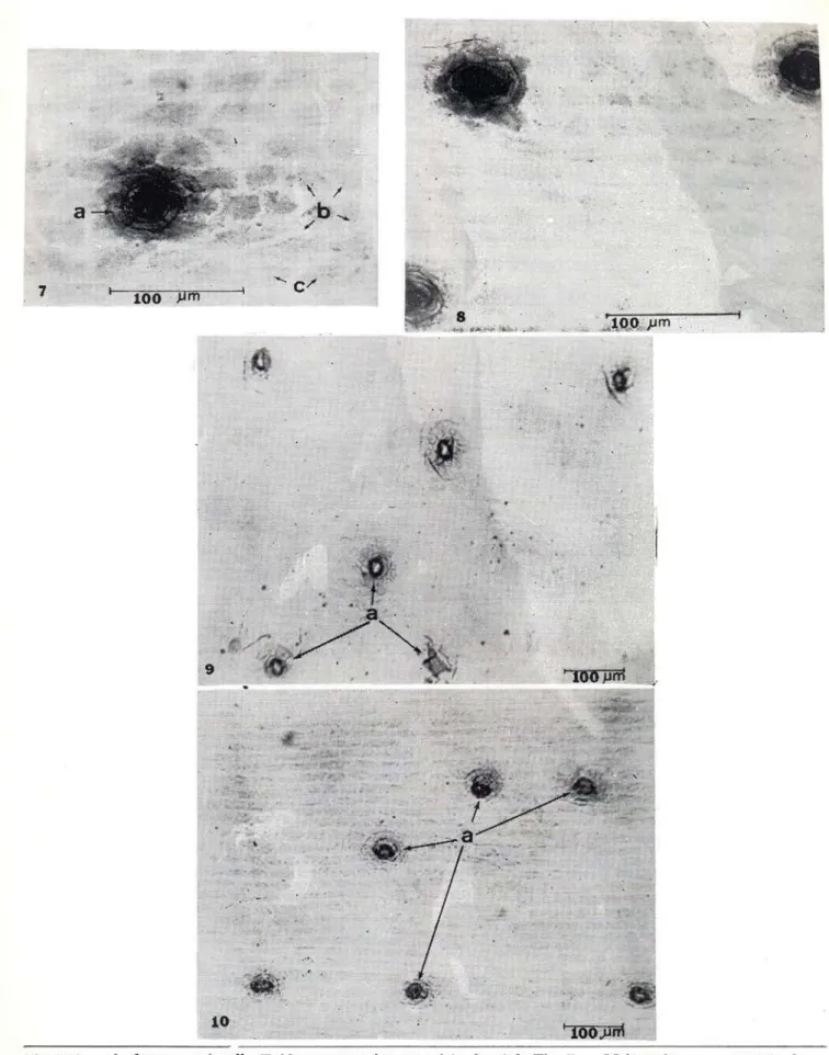 Fig. 7-10 — Aechmea mertensii. Epiderme superior  e m vista frontal; Pig. 7 — Meio-meio