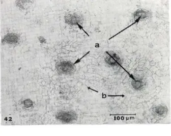 Fig. 42-44 — Aechmea setigera. Fig. 42 — Epiderme  superior em viste frontal. Base-meio