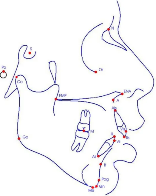 FIGURA 2 – Demarcação dos pontos cefalométricos. 