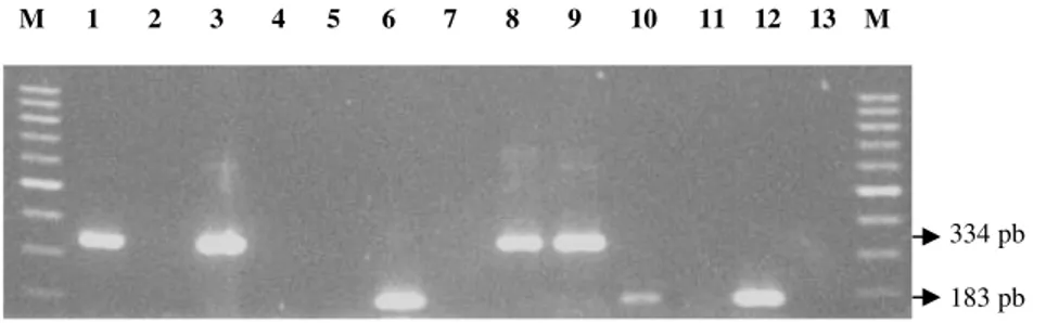 Figura 1: Produtos da transcrição reversa da reação em cadeia pela polimerase (RT-PCR) obtidos por  eletroforese em gel de agarose