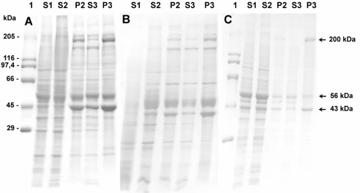 Figura 1. SDS-PAGE da precipitação de actomiosina de cérebro por congelamento. 