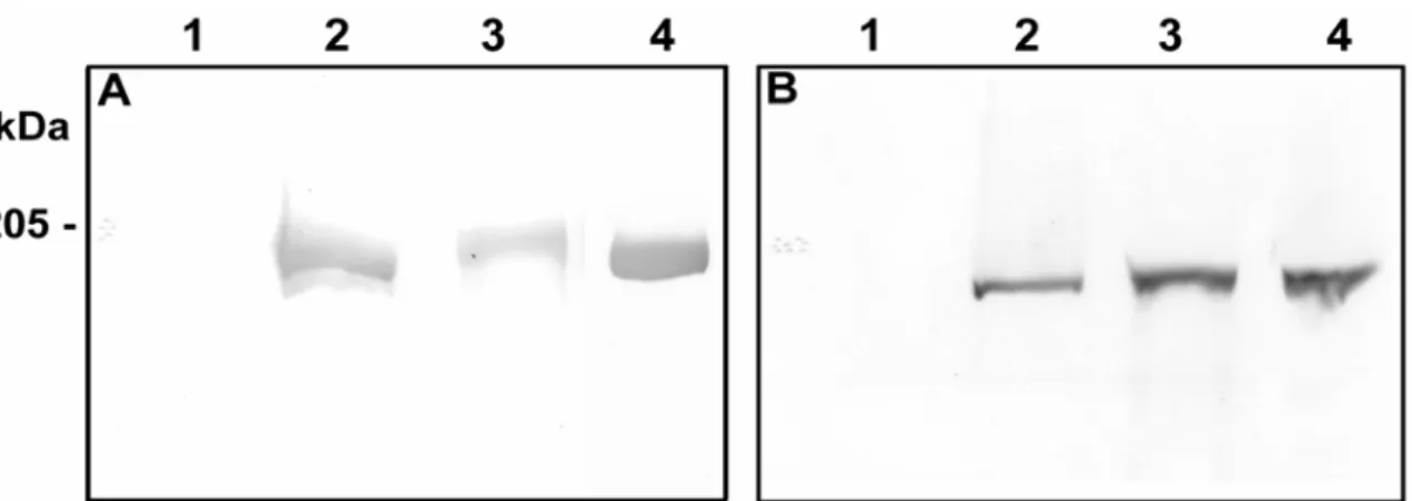 Figura 3. Immunoblotting das frações P3 de cérebro de suino, bovino e  pintainho. 