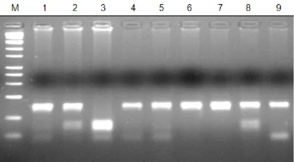 FIGURA 2. Gel de agarose apresentando os três possíveis genótipos após a restrição enzimática,  com respectivas bandas e pesos moleculares (TT – 152pb; TC  – 152, 84 e 68pb; CC – 84 e 68pb)