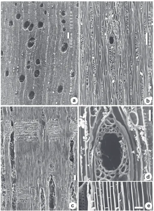 Figure 2.  Astronium graveolens (RBw 3733). Uncoated, IBCCF/UFRJ. - a: Transverse  section