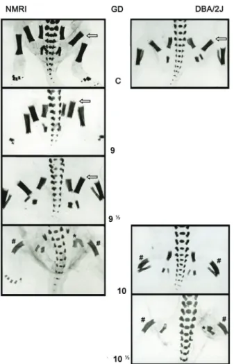 Figure 1 -  Skeleton anomalies in the hindlimbs induced by  a single administration of methylnitrosourea (MNU; 5 mg/