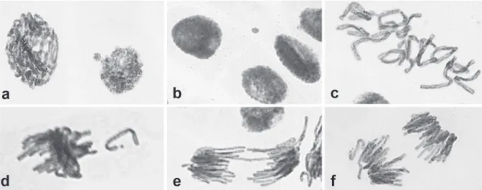 Figure 6 - Chromosomal abnormalities in meristem cells of Allium cepa exposed to the mixture of ursolic and oleanolic acids of  Mansoa hirsuta: (a) nuclear bud (100µg/mL); (b) micronucleus (100µg/mL); (c) C-metaphase (100µg/mL); (d) chromosomal  loss (10µg