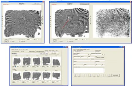 Figura 2 - Imagens das interfaces do Software de análise dermatoglifica   Fonte: Leitor Dermatoglífico, Nodari Júnior (2009) 