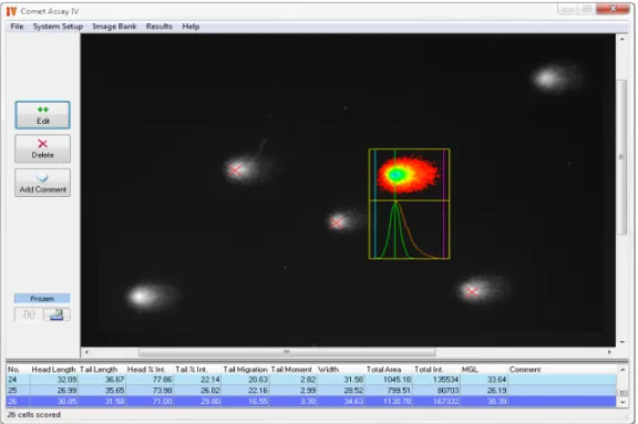 Figura 4 - Imagem representativa do funcionamento do software Comet Assay IVä (Perceptive  Instruments).