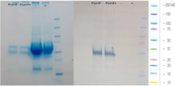 Figure 5.  Western blot/immunoprecipitation with pAb anti-T27K. A.  The serum  from  chronic  and  healthy  non-immune  patients  for  coccidioidomycosis  (+  and  -,  respectively)  before  and  after  immunoprecipitation  (Purif+  -  chronic  patients  a