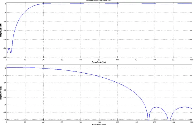 Figura 5.4.3 - Comportamento dos filtros utilizados. Em cima, filtro passa-alto, em baixo, filtro passa-baixo 