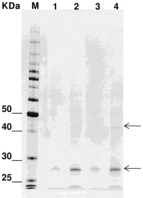 Figura  3:  SDS-PAGE  das  proteínas  imunoprecipitadas  pelos  beads  magnéticos  anti-His (6) 