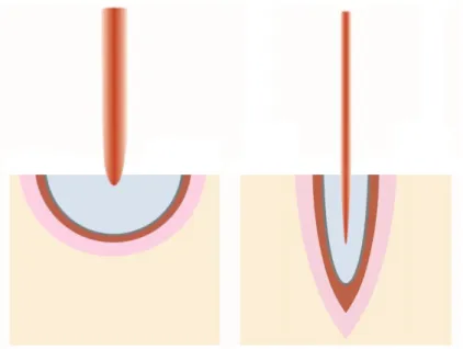 Figura 9: Representação esquemática dos vários tipos de interações de um  feixe de luz com um determinado material (adaptado de: Niemz, 2007)