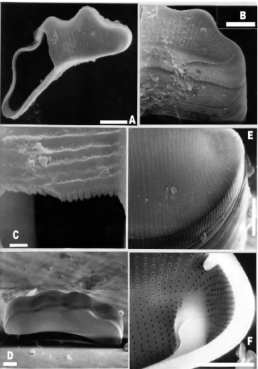 Figure 4. SEM. Scale bars: 1 μ πι: C, E; 5 μ πι: B, F: 10 μ πι: A, D. 