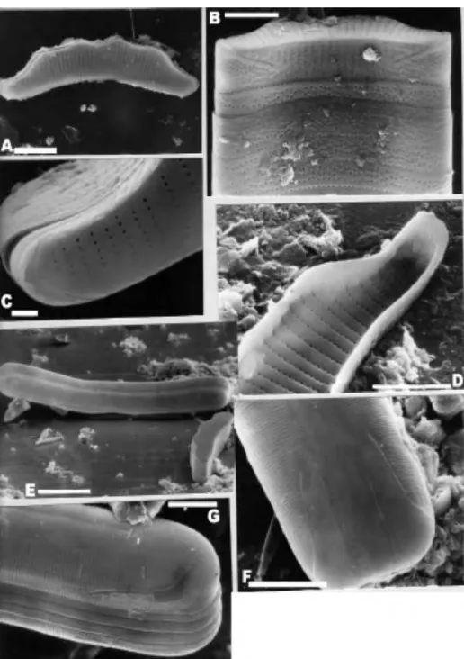 Figure 1. SEM. Scale bars: 1 μ Γη: C; 5 μ Γη: B, D, F; 10 μ Γη: A, E, G. 