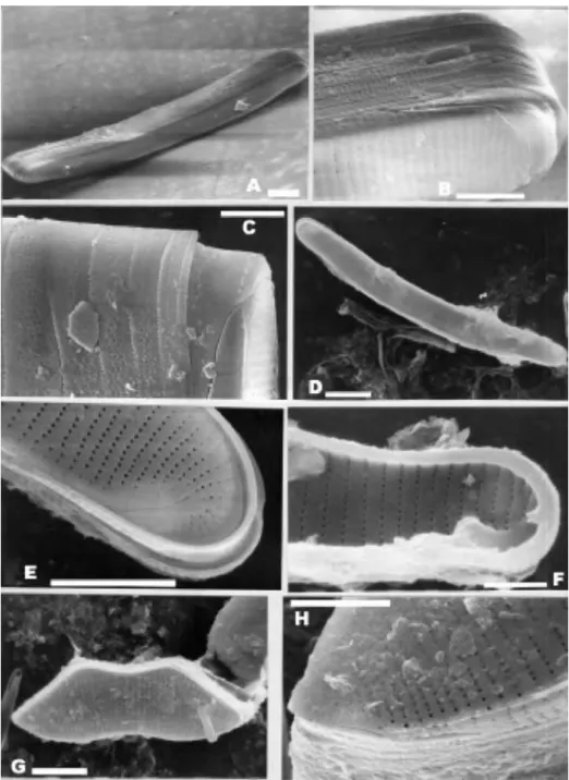 Figure 2. SEM. Scale bars: 5 μ ι^ B­C, E­F, H; 10 μ ι^ A, D, G. 