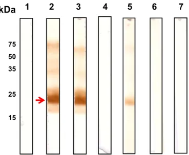 Figura  8.  Identificação  de  SAG2A  por  immunoblotting  em  fração  da  proteína  recombinante purificadas sondados com os mAbs A3A4 e A4D12 e soro policlonal
