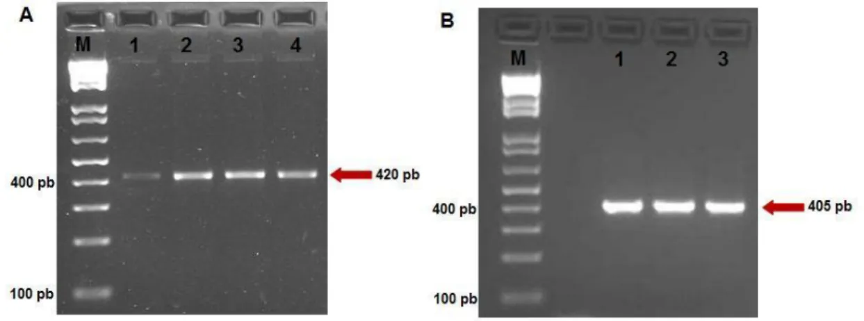Figura  9  -  Eletroforese  em  gel  de  agarose  a  2,0%  corado  com  brometo  de  etídio  mostrando  os  produtos amplificados após tratamento do DNA genômico com bissulfito de sódio