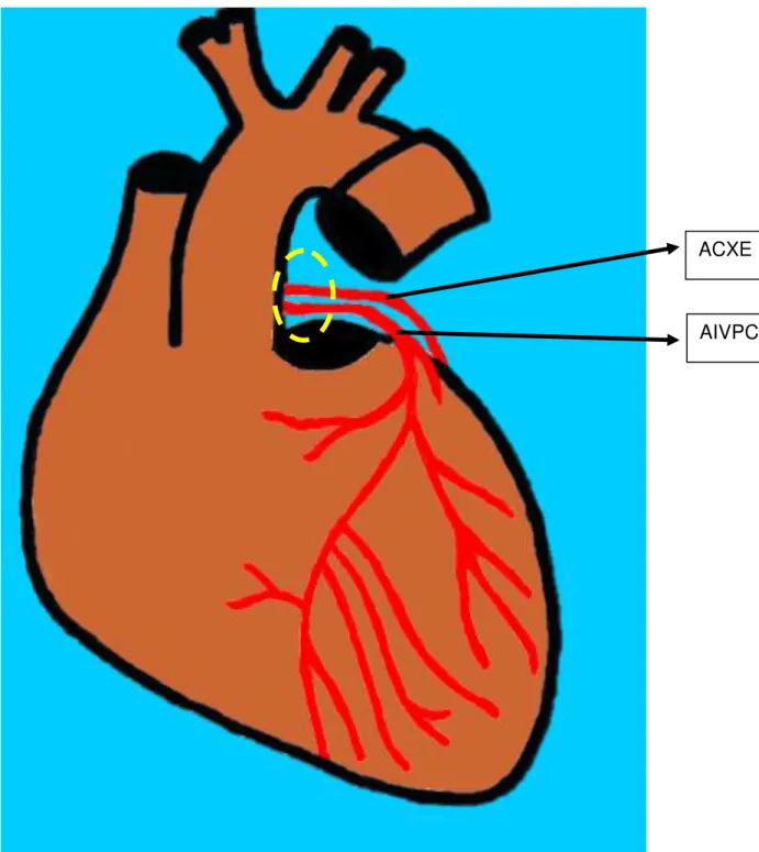 Figura  4.  Desenho  esquemático  da  face  auricular  do  coração  de  cebus  apella,  demonstrando  as  origens  distintas  das  artérias  circunflexa  esquerda (ACXE) e interventricular paraconal (AIVP)