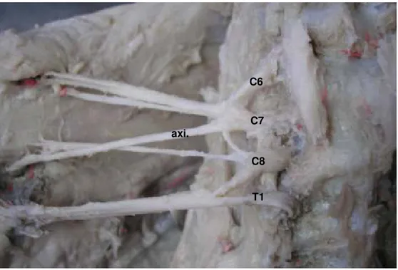 Figura 2. Fotografia da face ventral dos ramos ventrais dos nervos espinais cervicais  (C6 a C8) e torácicos (T1) mostrando a origem mais comum do nervo axilar  (axi.) em C7 e C8