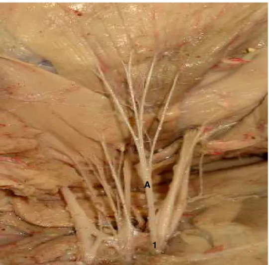 Figura 2. Fotografia da face medial do membro torácico de feto de suíno Pen Ar Lan                onde o nervo toracodorsal (A) originou-se de T1 (1)