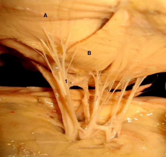 Figura 4. Fotografia da face medial do membro torácico de feto de suíno Pen                  Ar Lan onde o nervo toracodorsal (1) emitiu ramos para os músculos              grande dorsal (A) e redondo maior (B)