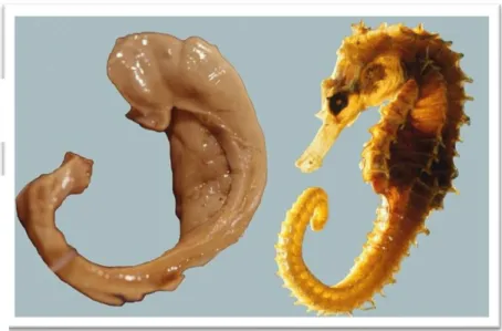 Figura 3. Imagem do hipocampo que se assemelha a um cavalo-marinho. Fonte: (102) 