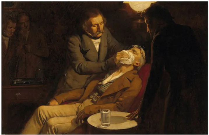 Figura 1 - Pintura a óleo executada por Ernest Board (1877-1934)  demonstrando a primeira utilização de anestesia geral com éter 