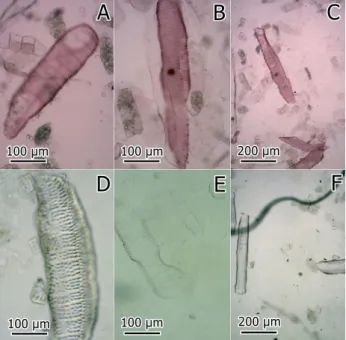 Figure 2. Light micrographs of dissociated material of secondary xylem  of cassava roots (Manihot esculenta) stained with safranin