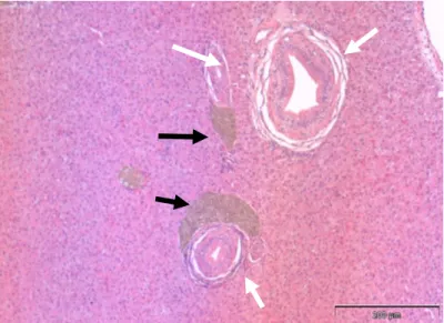 Figura 4. Microfotografia do fígado (corte transversal) de tainha capturada no estuário do Tejo (H&amp;E) onde  estão  representados  ductos  biliares  (setas  brancas)  sendo  que  dois  deles  estão  junto  a  agregados  macrofágicos (setas pretas), barr