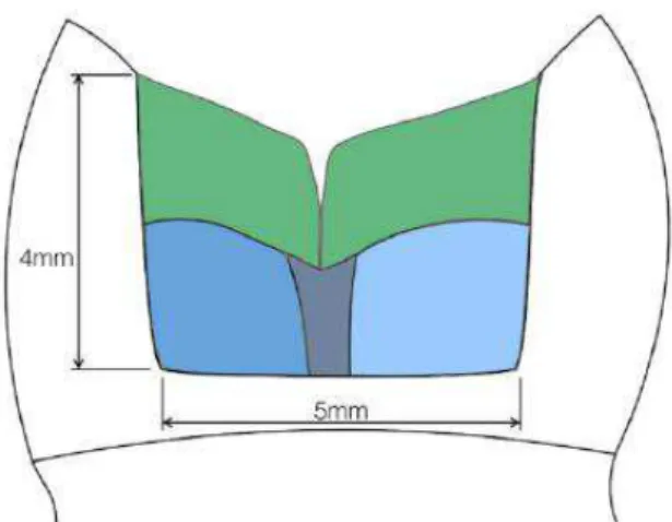 Figura 1Técnica Incremental (Adptada: Hirata et al, 2015). 