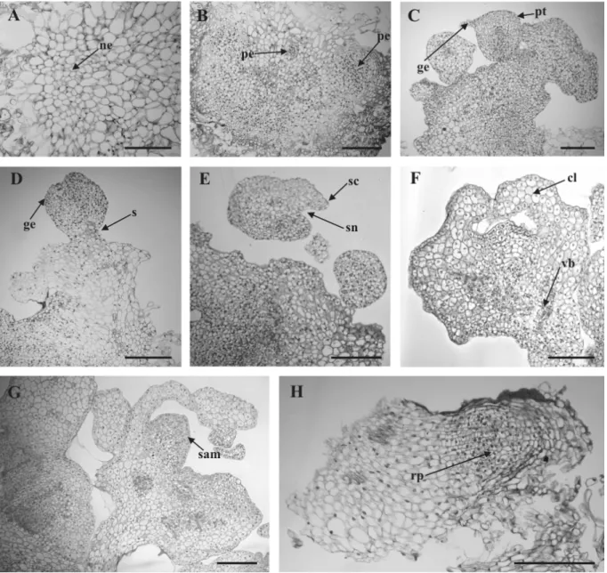 Figure 5. Histological study of somatic embryogenesis of the sugarcane cultivar RB72454