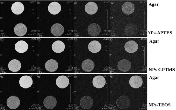 Fig. 7 presents MRI of zebra- ﬁ shes injected with core e shell NPs- NPs-TEOS where a detail similar the ones injected with core e shell  NPs-APTES was observed.