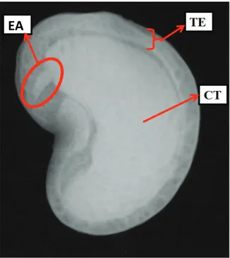 Figure 1. Radiographic image of an achene of Anacardium  othonianum Rizz, highlighting the embryonic axis (EA), tegument  (TE), and the cotyledons (CT)