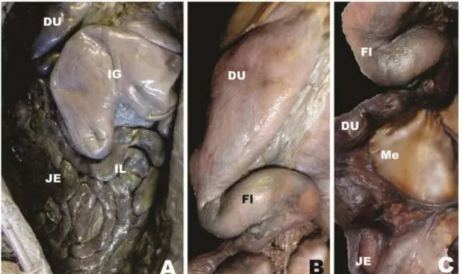 Figura  8:  Fotomacrografia  do  intestino  delgado  de  Myrmecophaga  tridactyla.  (A)  localização  do  intestino  delgado  na  cavidade  abdominal;  (BC)  morfologia  externa  do  duodeno