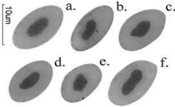 Fig.  4.  Alterações  nucleares  em  células  animais.  Tipos  -  a:  núcleo  normal,  b: 