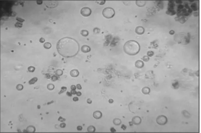 Figure 1.  E. elatior protoplasts isolated after 15 hours of  incubation in enzyme solution E (40x)