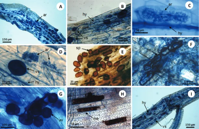 Figure 1. Arbuscular mycorrhizal and dark septate endophytic fungi in roots of weeds in Brazil