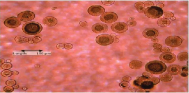 Figure 3. A Microphotograph showing the lipid-walled  microcapsule in the gut larvae of O