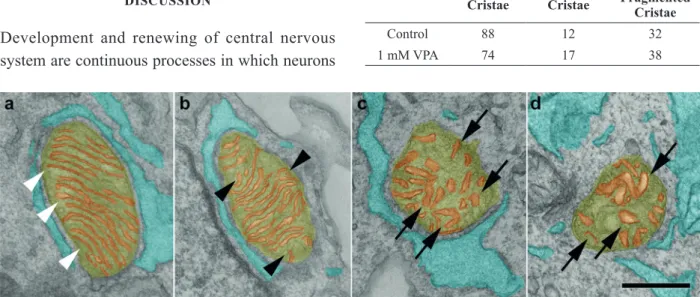 Figure 1 - Mitochondrial cristae are affected after VPA treatment. (a) Transmission electron microscopy showed that control cells  presented regular distribution of thin and parallel oriented cristae in mitochondria (white arrowheads)