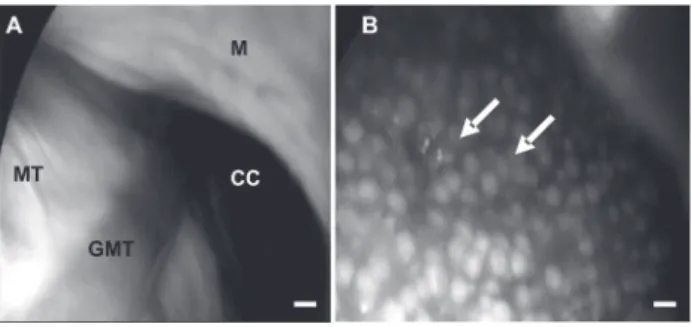 Figure 2 - Detail of laparoscopic examination of pirarucu gonads. A: male  (CC) shows celomic cavity