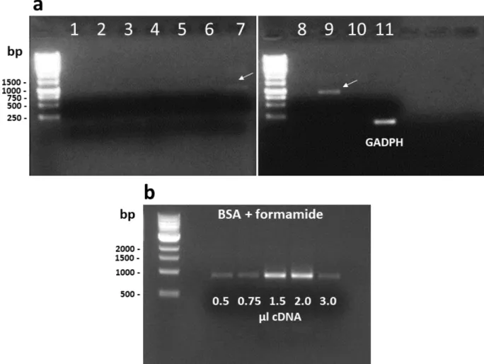 Figure 3 - RT-PCR amplification of CAD (a) using different adjuvants at varied concentrations and with BSA + formamide and  varied amount of cDNA in the reaction mixture (b)